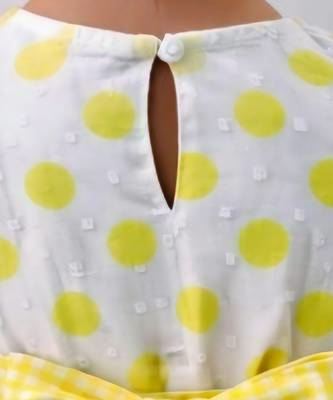Yellow printed cotton dress 3