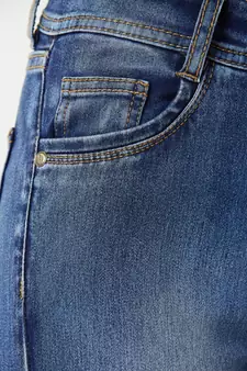 Artist Zip Crop Skinny Jeans