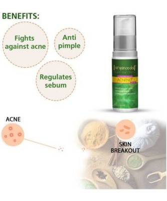 Aryanveda Acnend Serum 50ml (Pack of 2) 4