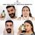 Organic Anti Acne, Pimple Scar Spots Removal Cream Gel For Men & Women